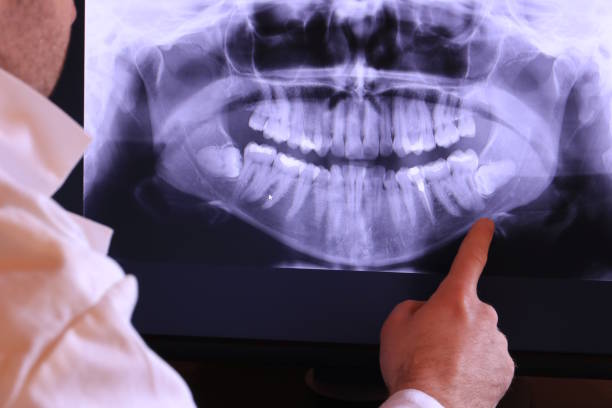 Best Emergency Tooth Extraction in Waynesburg, OH